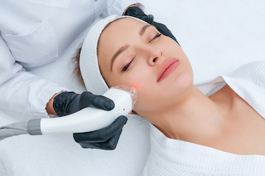 Laser Face Hair Removal in Surrey